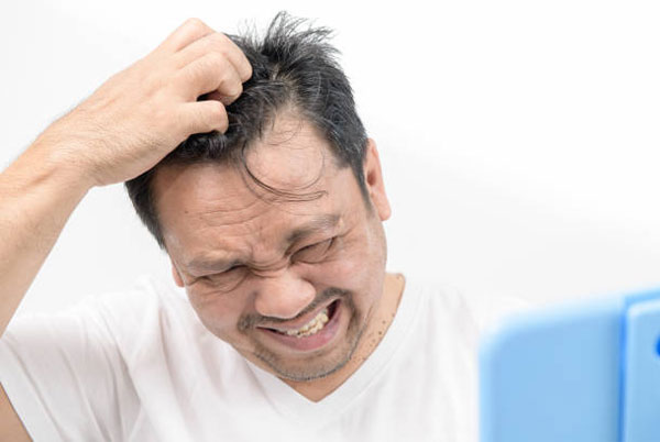 Bệnh vảy nến da đầu gây ngứa ngáy